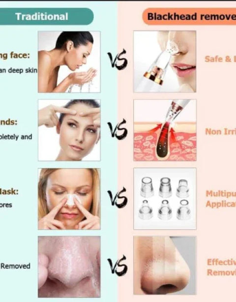 6 in 1 Multi-function Blackhead Remover Tools - BUYSQUARE