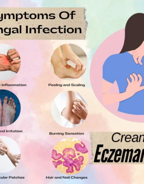 Eczemaron Fungal Cream for Men & Women ( Pack Of 2 ) - BUYSQUARE